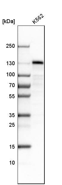 stonin-2 Antibody - BSA Free Western Blot: stonin-2 Antibody - BSA Free [NBP1-90658]