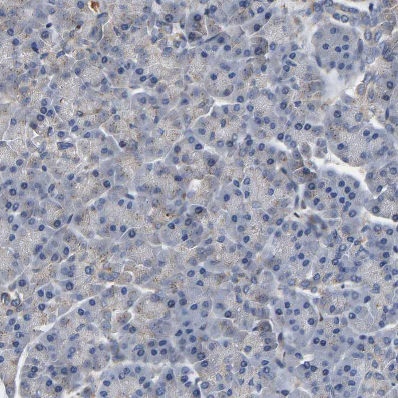 ferric-chelate reductase 1 Antibody - BSA Free Immunohistochemistry: ferric-chelate reductase 1 Antibody - BSA Free [NBP1-90668]