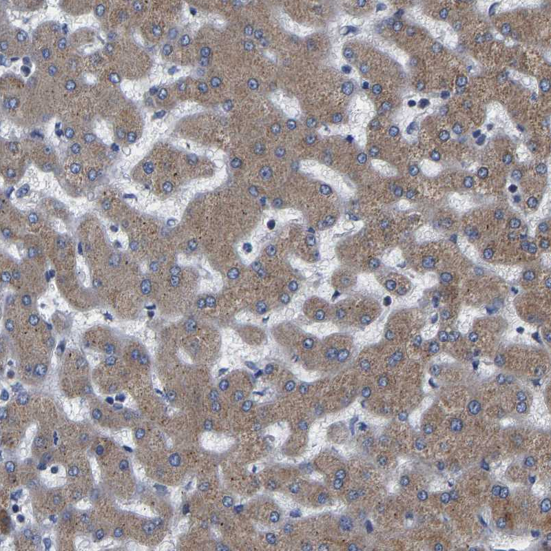 ferric-chelate reductase 1 Antibody - BSA Free Immunohistochemistry: ferric-chelate reductase 1 Antibody - BSA Free [NBP1-90668]
