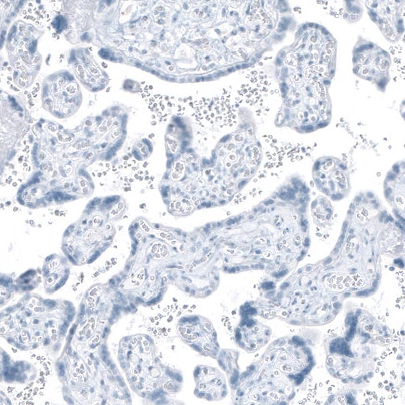 HSD17B13 Antibody - BSA Free Immunohistochemistry: HSD17B13 Antibody - BSA Free [NBP1-90669]