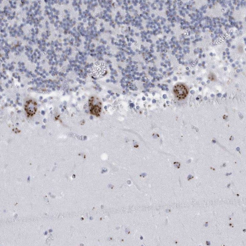 FAM207A Antibody - BSA Free Immunohistochemistry-Paraffin: FAM207A Antibody [NBP1-90676]