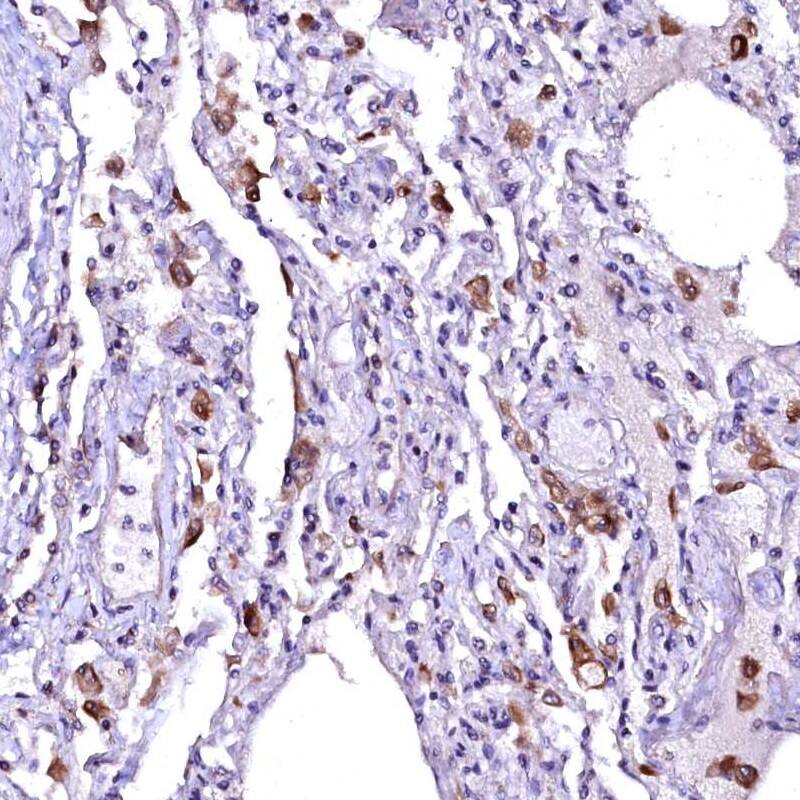 ovochymase-1 Antibody - BSA Free Immunohistochemistry-Paraffin: ovochymase-1 Antibody [NBP1-90682]