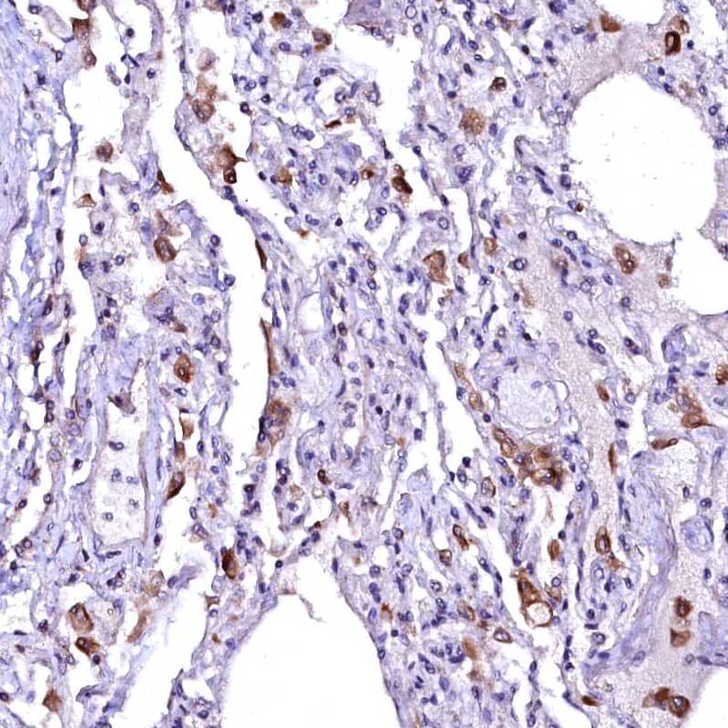ovochymase-1 Antibody - BSA Free Immunohistochemistry: ovochymase-1 Antibody - BSA Free [NBP1-90682]
