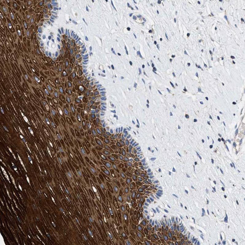 TOMM6 Antibody - BSA Free Immunohistochemistry: TOMM6 Antibody - BSA Free [NBP1-90688]