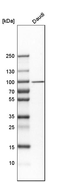 UFL1 Antibody - BSA Free Western Blot: UFL1 Antibody - BSA Free [NBP1-90692]