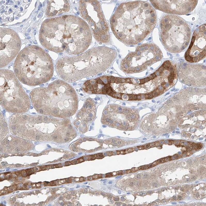 UFL1 Antibody - BSA Free Immunohistochemistry: UFL1 Antibody - BSA Free [NBP1-90693]