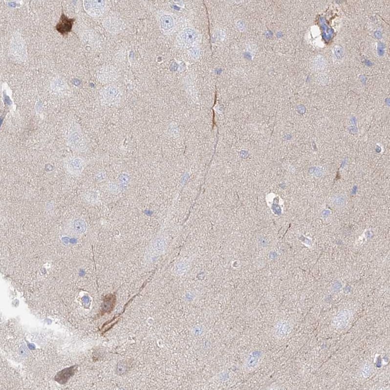 UFL1 Antibody - BSA Free Immunohistochemistry: UFL1 Antibody - BSA Free [NBP1-90693]