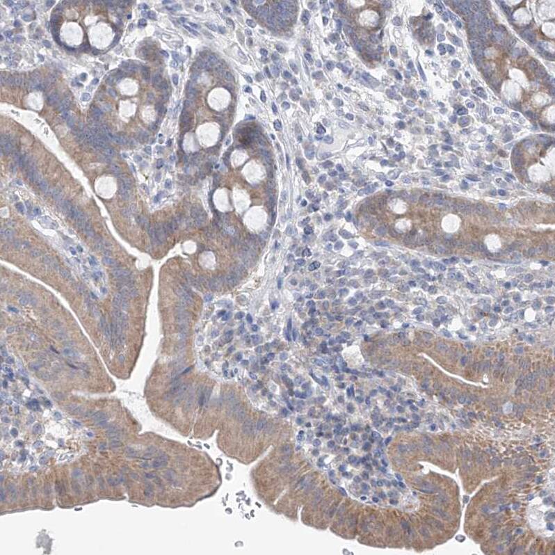 UFL1 Antibody - BSA Free Immunohistochemistry: UFL1 Antibody - BSA Free [NBP1-90693]