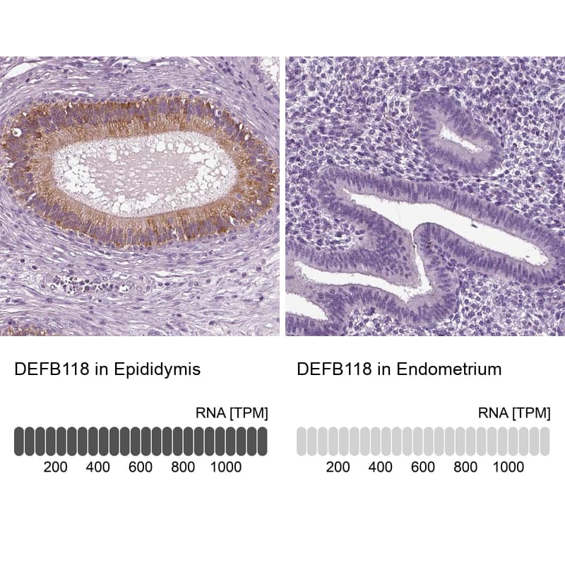 DEFB118 Antibody - BSA Free Immunohistochemistry: DEFB118 Antibody - BSA Free [NBP1-90695]