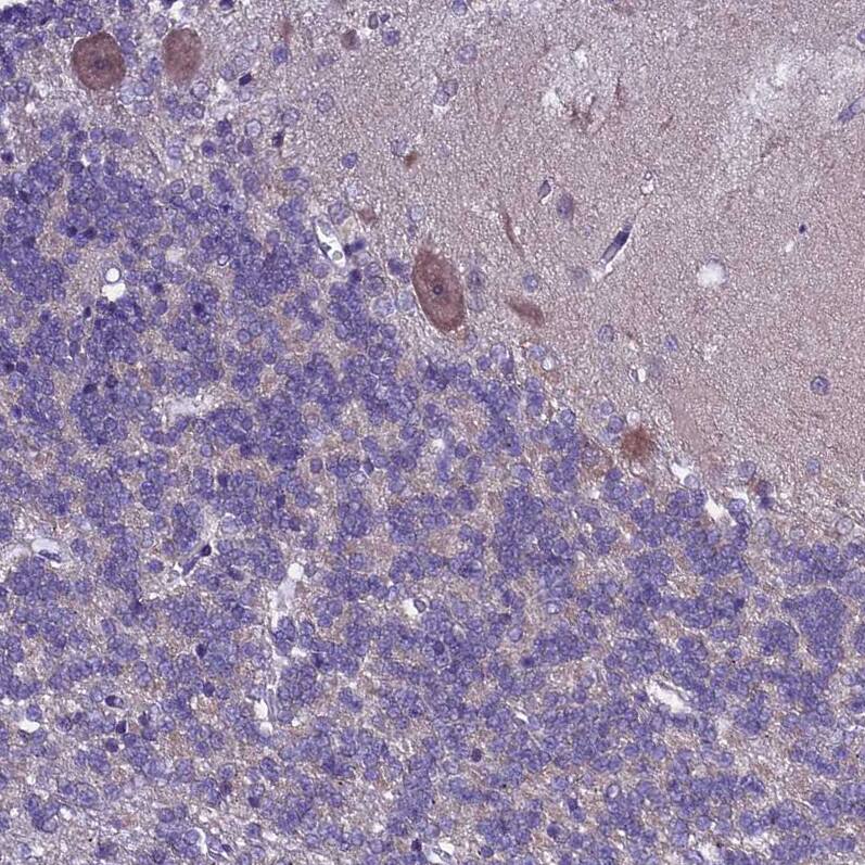 XKR7 Antibody - BSA Free Immunohistochemistry: XKR7 Antibody - BSA Free [NBP1-90697]