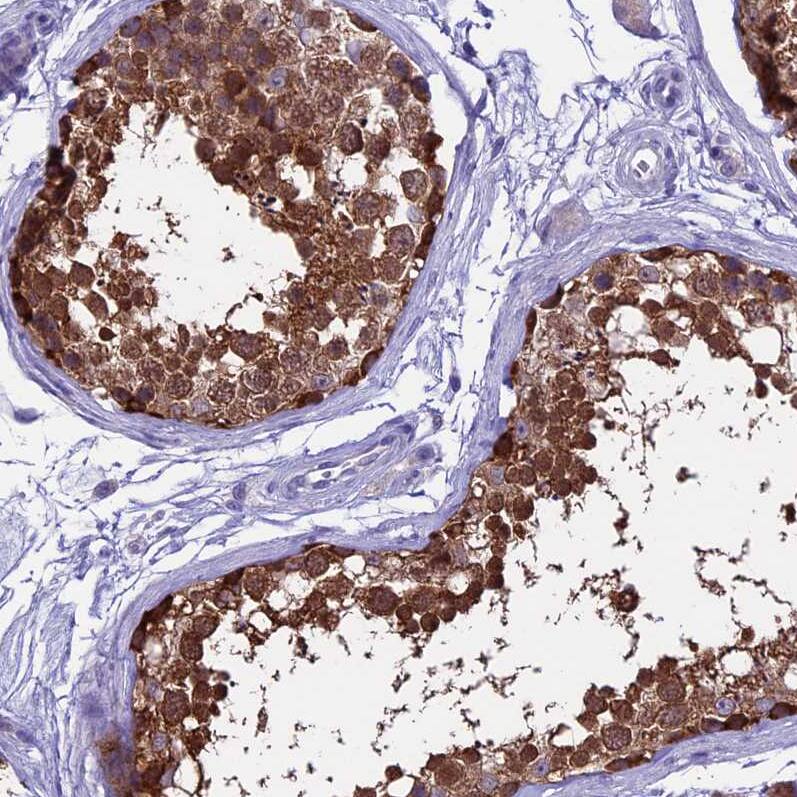 XKR7 Antibody - BSA Free Immunohistochemistry: XKR7 Antibody - BSA Free [NBP1-90697]
