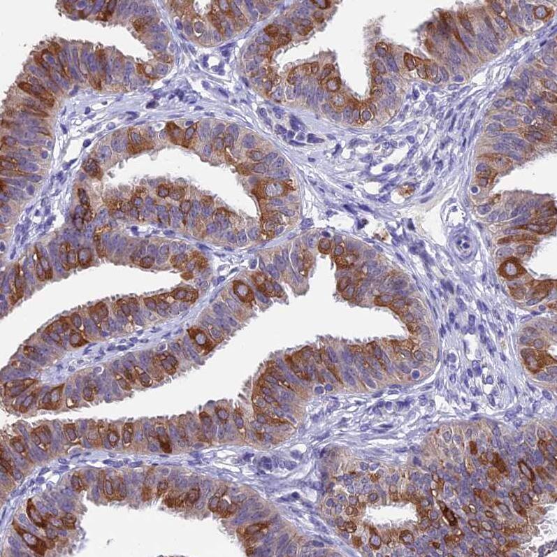 XKR7 Antibody - BSA Free Immunohistochemistry: XKR7 Antibody - BSA Free [NBP1-90697]
