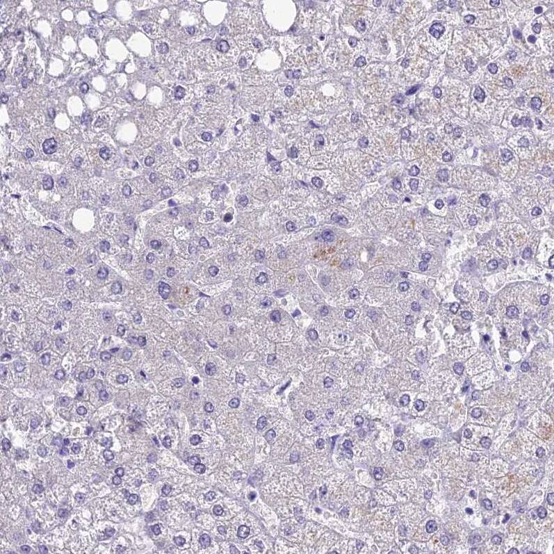 XKR7 Antibody - BSA Free Immunohistochemistry: XKR7 Antibody - BSA Free [NBP1-90697]