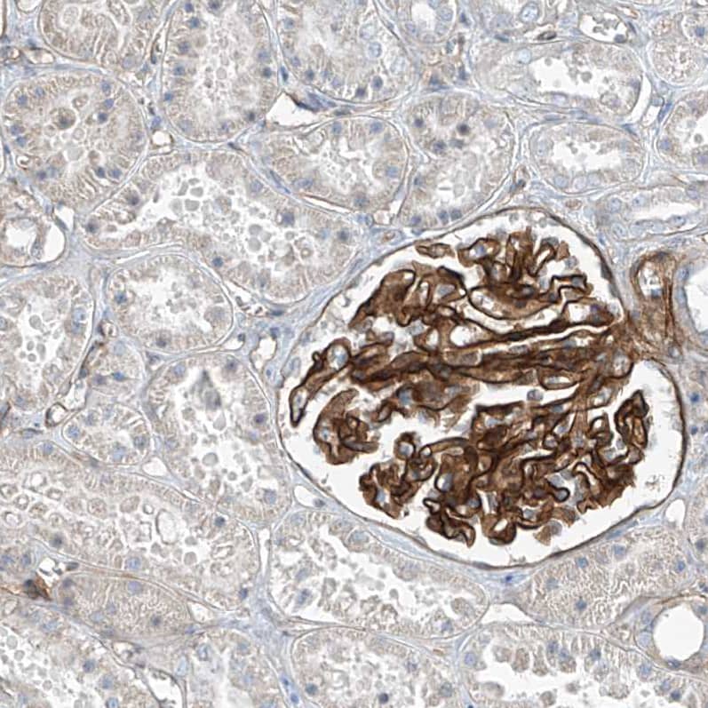 TENC1 Antibody - BSA Free Immunohistochemistry-Paraffin: TENC1 Antibody [NBP1-90698]