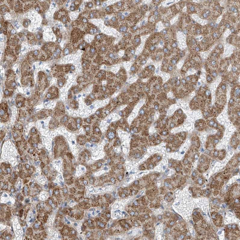 TENC1 Antibody - BSA Free Immunohistochemistry-Paraffin: TENC1 Antibody [NBP1-90698]