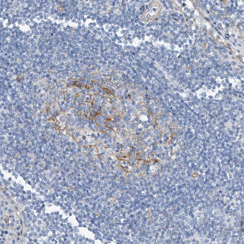 TENC1 Antibody - BSA Free Immunohistochemistry: TENC1 Antibody - BSA Free [NBP1-90698]