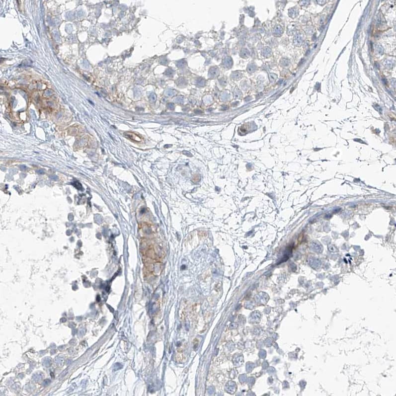 TENC1 Antibody - BSA Free Immunohistochemistry: TENC1 Antibody - BSA Free [NBP1-90698]
