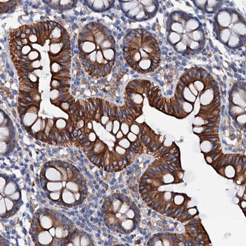 Otolin-1 Antibody - BSA Free Immunohistochemistry: Otolin-1 Antibody - BSA Free [NBP1-90699]