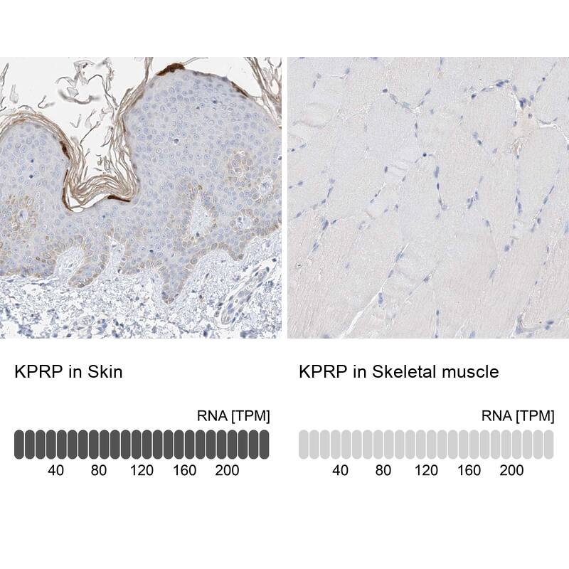 KPRP Antibody - BSA Free Immunohistochemistry: KPRP Antibody - BSA Free [NBP1-90707]