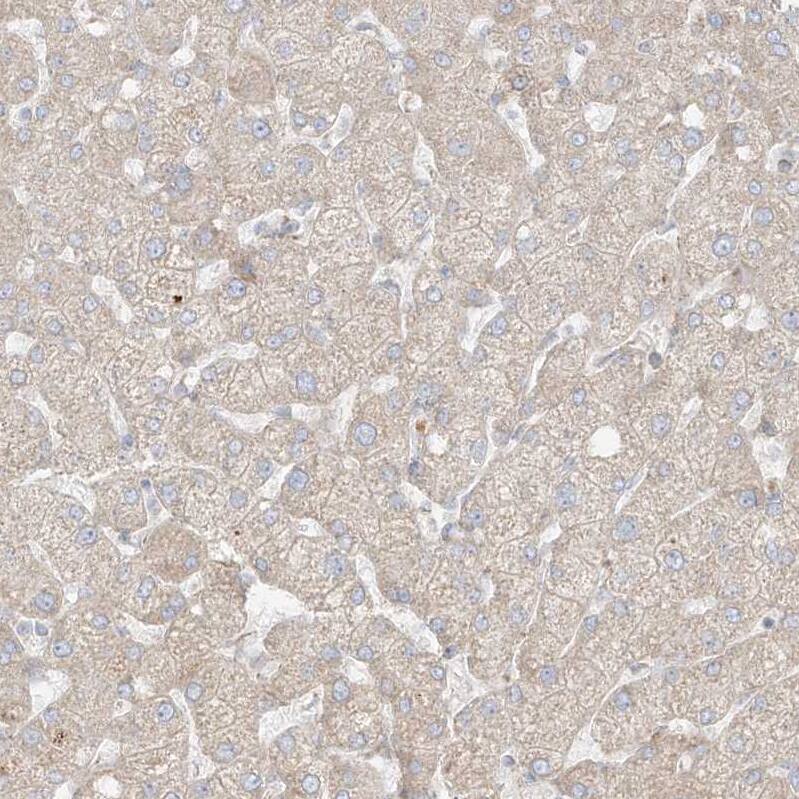 GLT25D2 Antibody - BSA Free Immunohistochemistry: GLT25D2 Antibody - BSA Free [NBP1-90711]