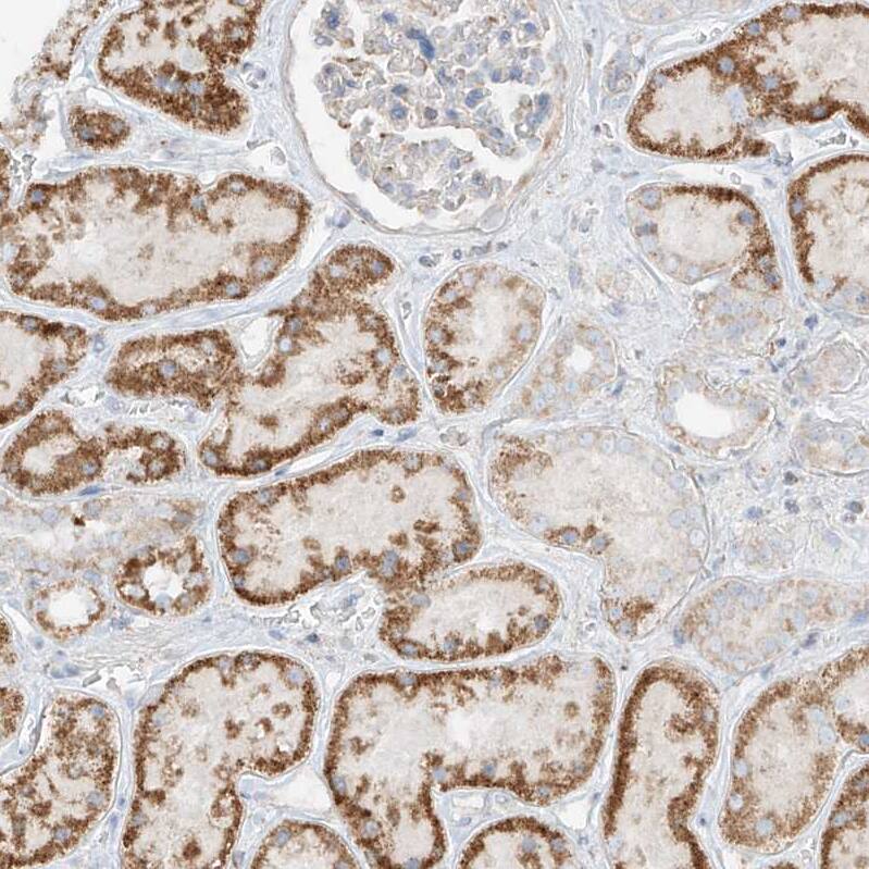 GLT25D2 Antibody - BSA Free Immunohistochemistry: GLT25D2 Antibody - BSA Free [NBP1-90711]