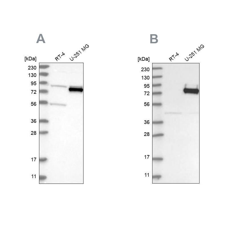GLT25D2 Antibody - BSA Free Western Blot: GLT25D2 Antibody - BSA Free [NBP1-90712]
