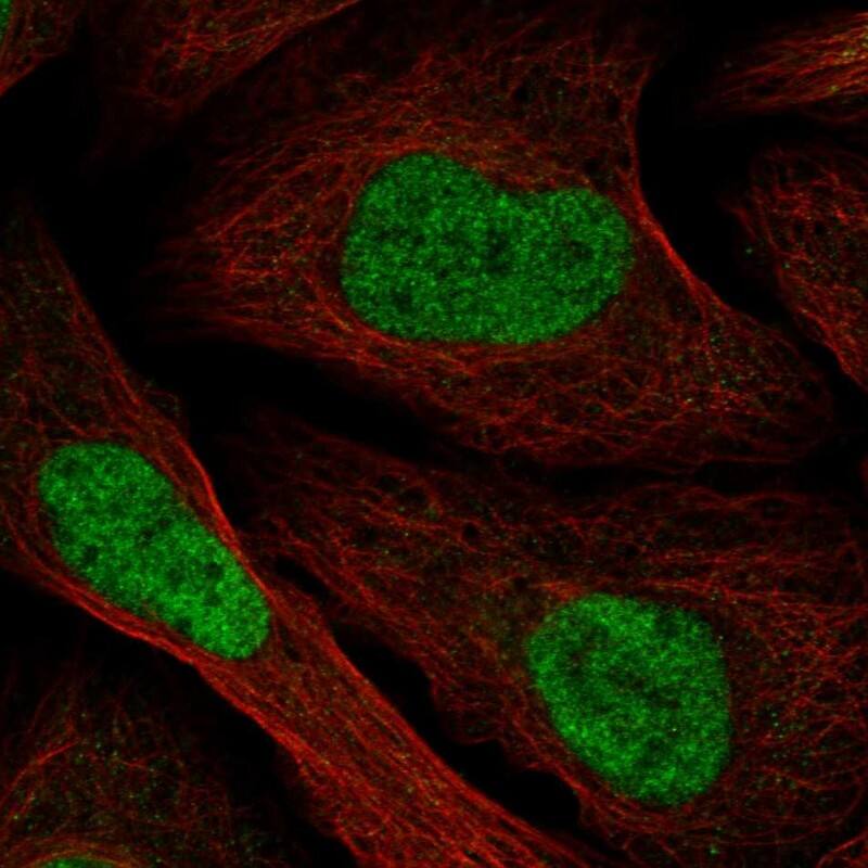 TMEM69 Antibody - BSA Free Immunocytochemistry/ Immunofluorescence: TMEM69 Antibody - BSA Free [NBP1-90713]