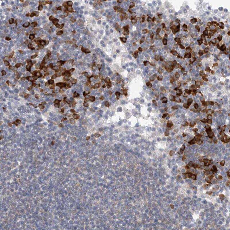 TMEM69 Antibody - BSA Free Immunohistochemistry: TMEM69 Antibody - BSA Free [NBP1-90713]