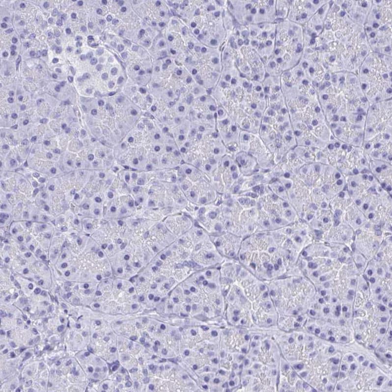 SHCBP1L Antibody - BSA Free Immunohistochemistry: SHCBP1L Antibody - BSA Free [NBP1-90716]