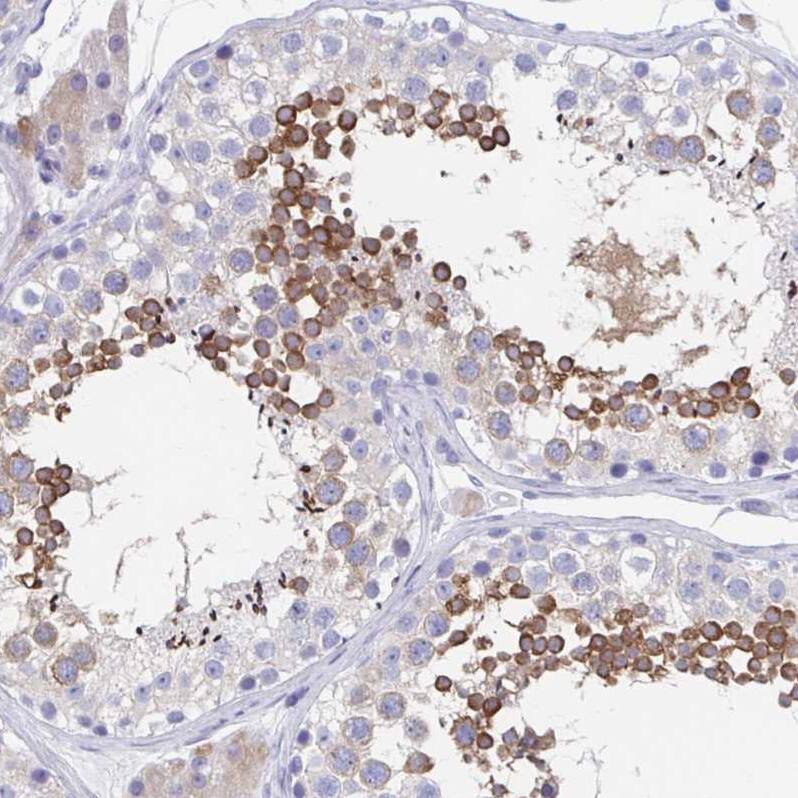 SHCBP1L Antibody - BSA Free Immunohistochemistry: SHCBP1L Antibody - BSA Free [NBP1-90716]