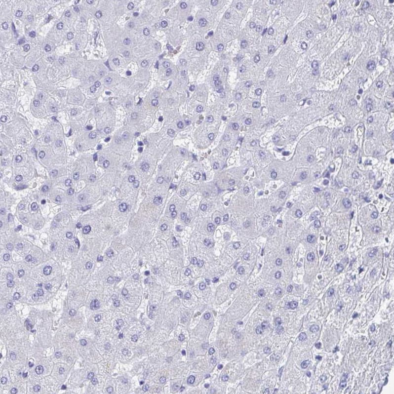 SHCBP1L Antibody - BSA Free Immunohistochemistry: SHCBP1L Antibody - BSA Free [NBP1-90716]