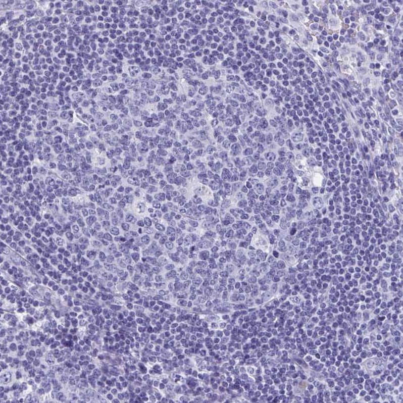 SHCBP1L Antibody - BSA Free Immunohistochemistry: SHCBP1L Antibody - BSA Free [NBP1-90716]