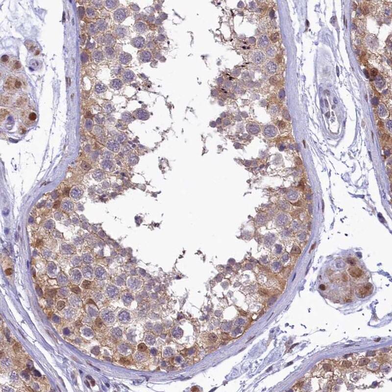 IZUMO2 Antibody - BSA Free Immunohistochemistry: IZUMO2 Antibody - BSA Free [NBP1-90720]