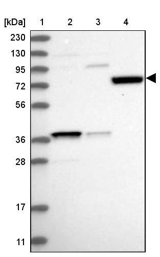 SAMD15 Antibody - BSA Free Western Blot: SAMD15 Antibody - BSA Free [NBP1-90726]