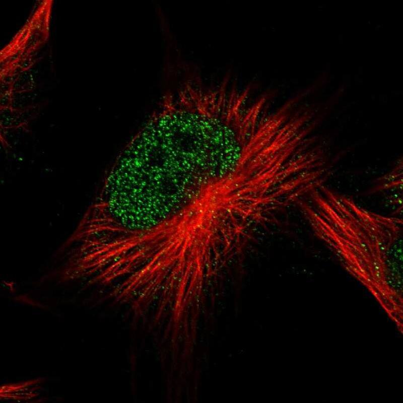 ATG2B Antibody - BSA Free Immunocytochemistry/ Immunofluorescence: ATG2B Antibody [NBP1-90732]