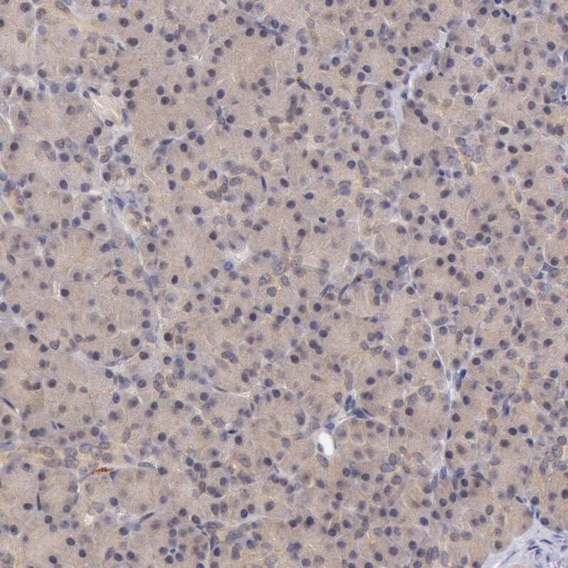 ATG2B Antibody - BSA Free Immunohistochemistry: ATG2B Antibody - BSA Free [NBP1-90732]
