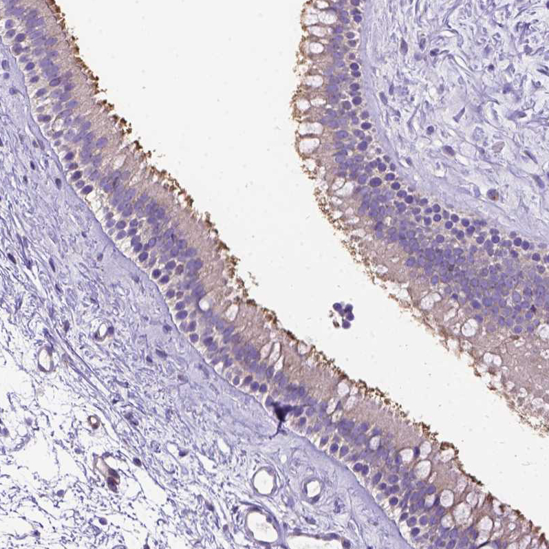 CFAP54 Antibody - BSA Free Immunohistochemistry: CFAP54 Antibody - BSA Free [NBP1-90737]
