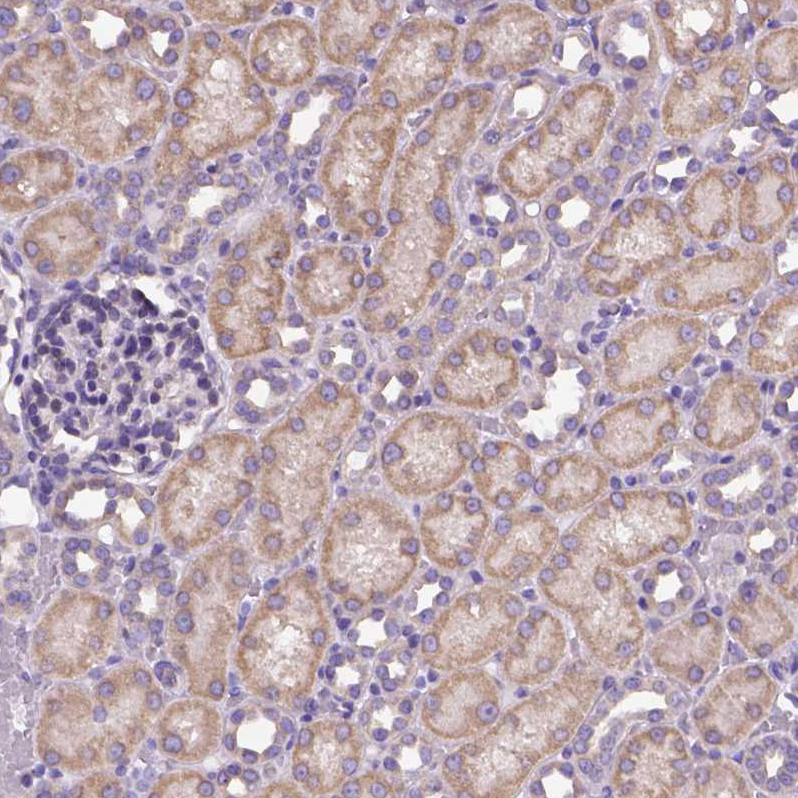 CFAP54 Antibody - BSA Free Immunohistochemistry: CFAP54 Antibody - BSA Free [NBP1-90737]