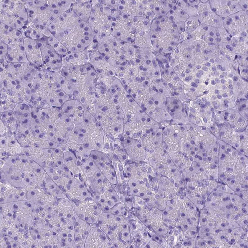 CFAP54 Antibody - BSA Free Immunohistochemistry: CFAP54 Antibody - BSA Free [NBP1-90737]