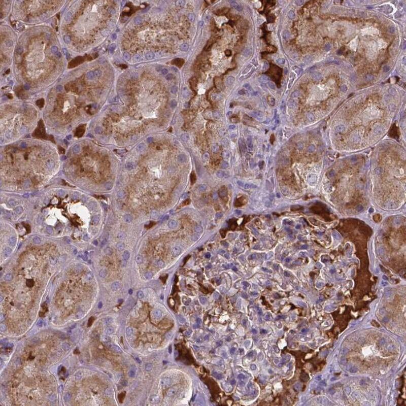 BTBD17 Antibody - BSA Free Immunohistochemistry: BTBD17 Antibody - BSA Free [NBP1-90749]