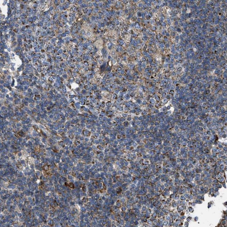 CD277/BTN3A1 Antibody - BSA Free Immunohistochemistry: CD277/BTN3A1 Antibody - BSA Free [NBP1-90750]