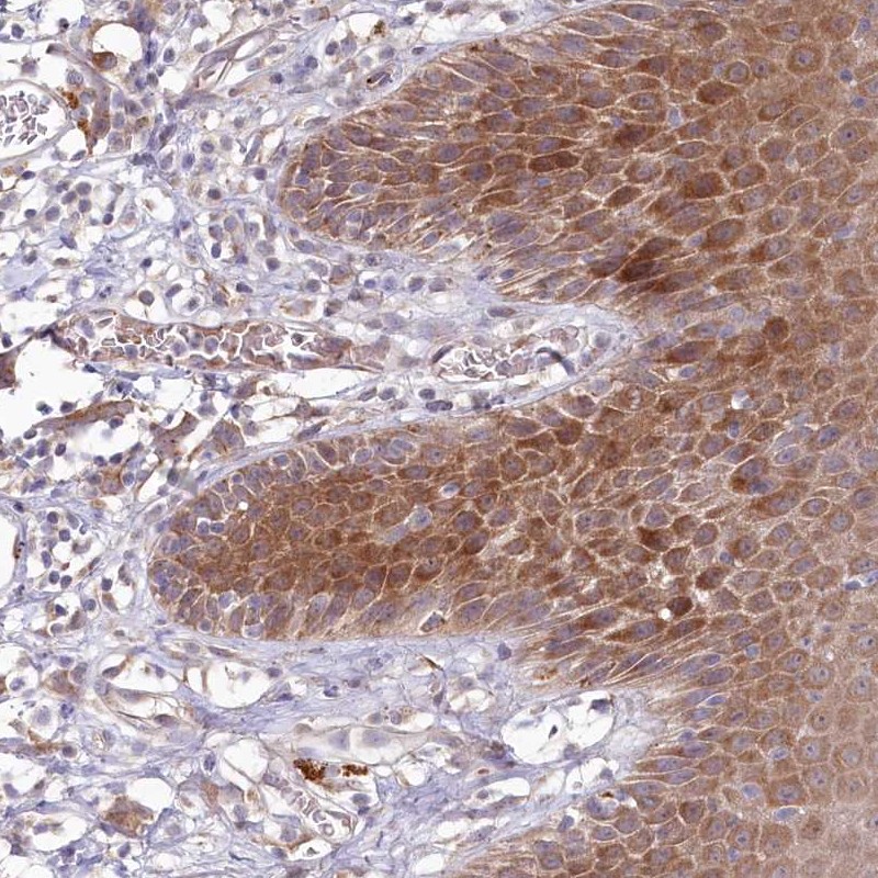 BPIL2 Antibody - BSA Free Immunohistochemistry: BPIL2 Antibody - BSA Free [NBP1-90753]