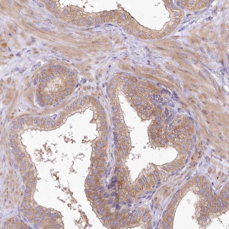 BIG3 Antibody - BSA Free Immunohistochemistry: BIG3 Antibody - BSA Free [NBP1-90759]