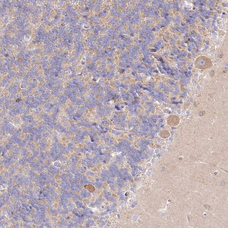 BIG3 Antibody - BSA Free Immunohistochemistry: BIG3 Antibody - BSA Free [NBP1-90759]