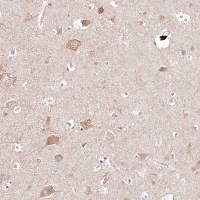 BIG3 Antibody - BSA Free Immunohistochemistry: BIG3 Antibody - BSA Free [NBP1-90759]