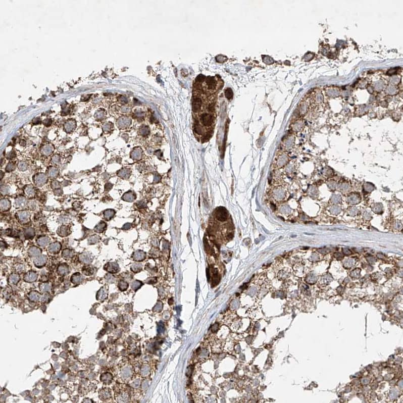 UQCC Antibody - BSA Free Immunohistochemistry-Paraffin: UQCC Antibody [NBP1-90766]