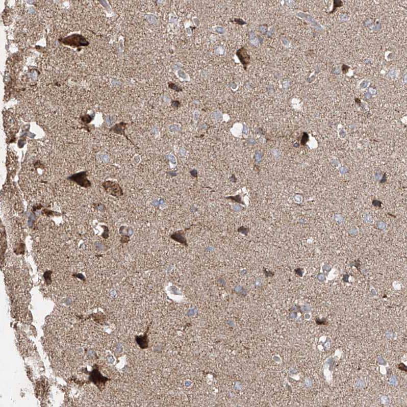 UQCC Antibody - BSA Free Immunohistochemistry-Paraffin: UQCC Antibody [NBP1-90766]