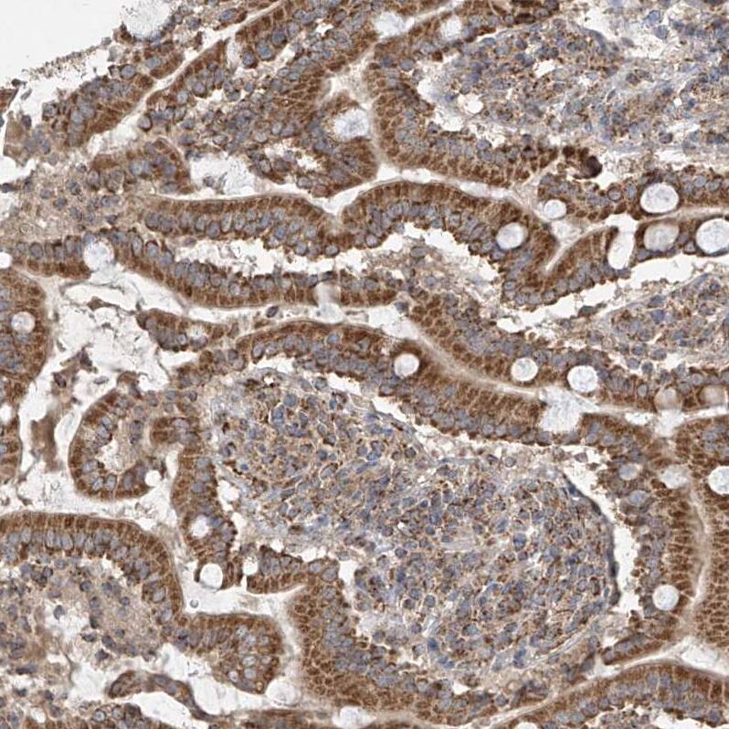 UQCC Antibody - BSA Free Immunohistochemistry-Paraffin: UQCC Antibody [NBP1-90766]