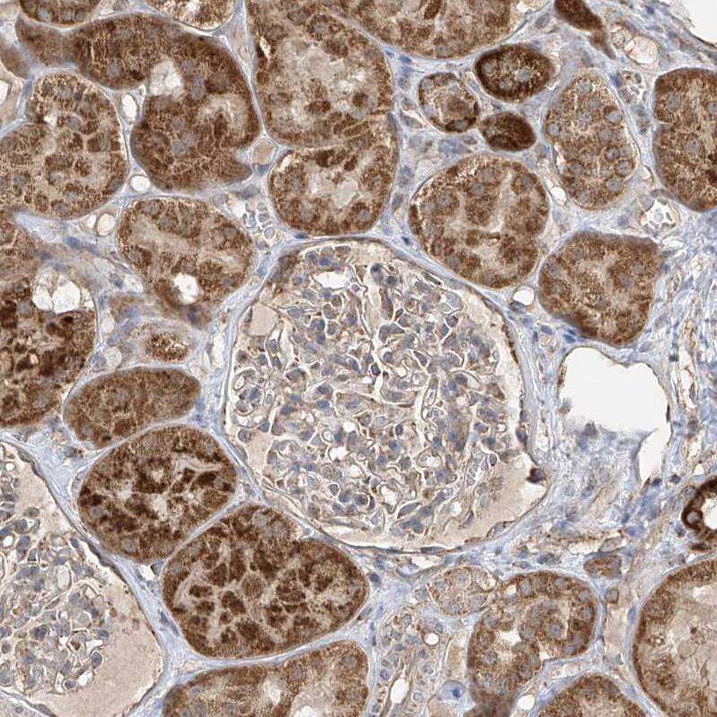 UQCC Antibody - BSA Free Immunohistochemistry-Paraffin: UQCC Antibody [NBP1-90766]