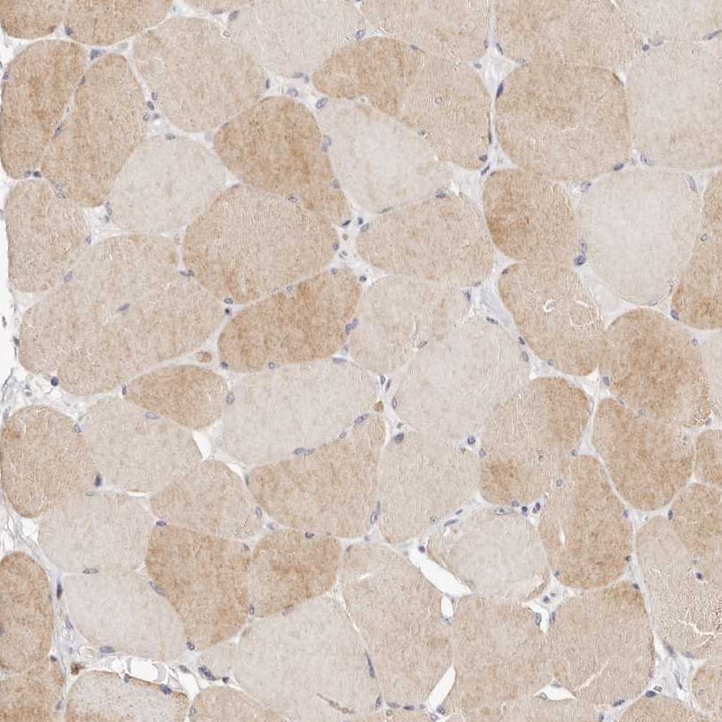 BCL2L15 Antibody - BSA Free Immunohistochemistry: BCL2L15 Antibody - BSA Free [NBP1-90767]